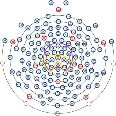 The Effects of Repeated Dyspnea Exposure on Response Inhibition